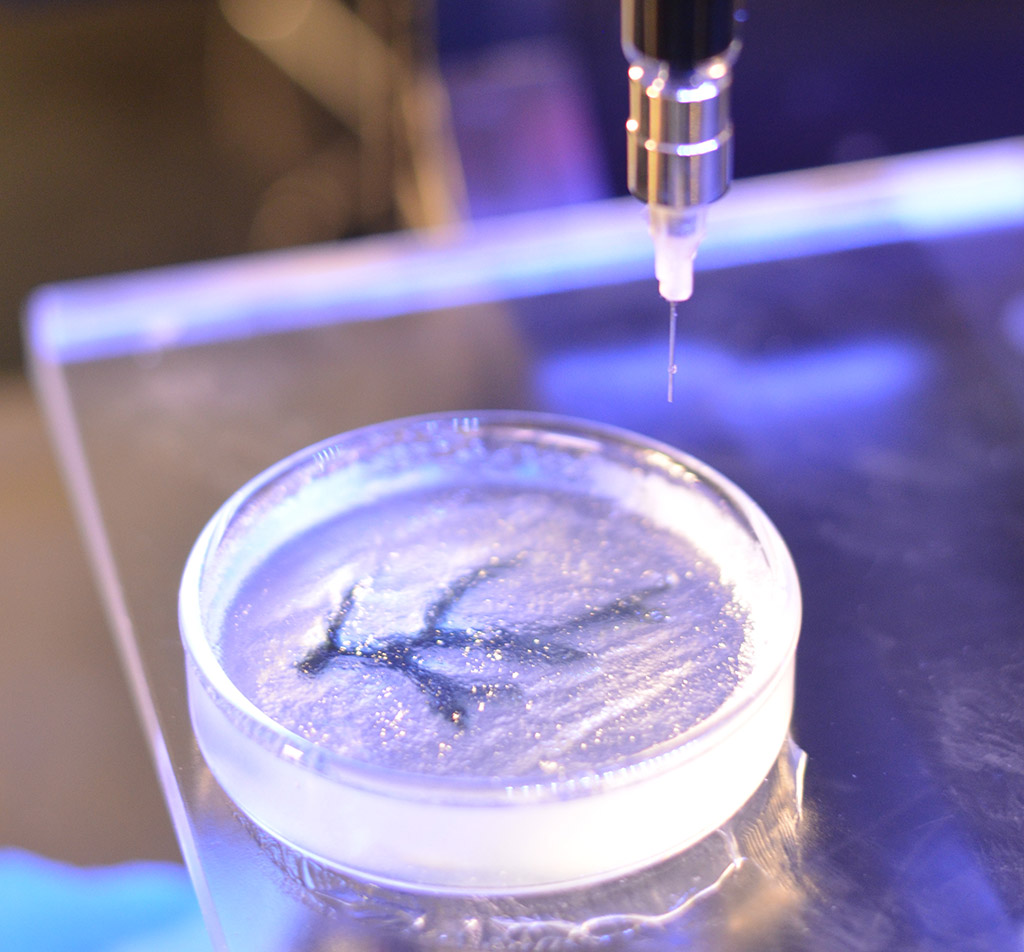 3D printed coronary artery, 3D printing in healthcare