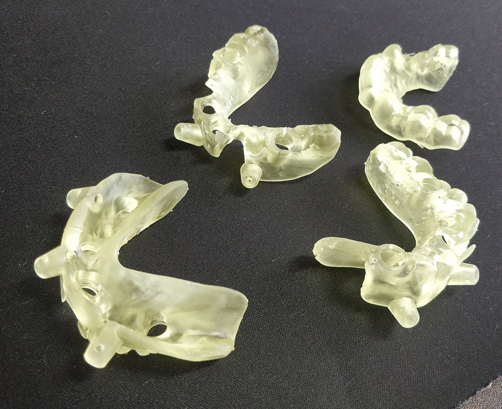 Dental guides printed using SLA, 3d printing in healthcare